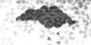 Nuage-Pluie